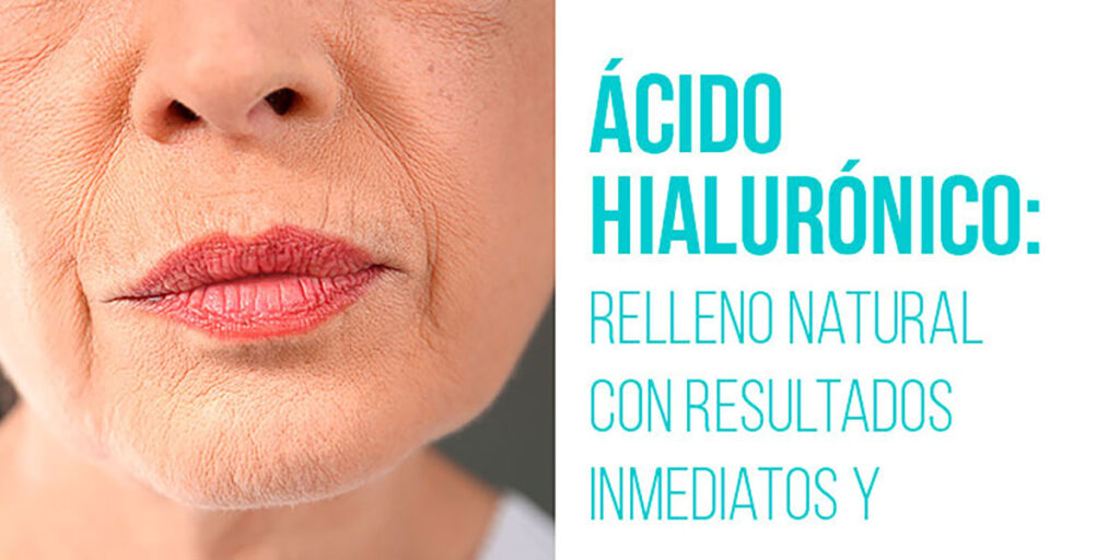 ÁCIDO HIALURÓNICO: RELLENO NATURAL CON RESULTADOS INMEDIATOS